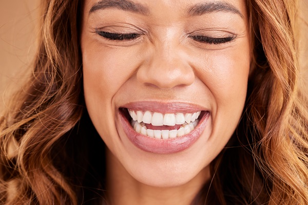 Smile Makeover: Crowns Or Veneers?